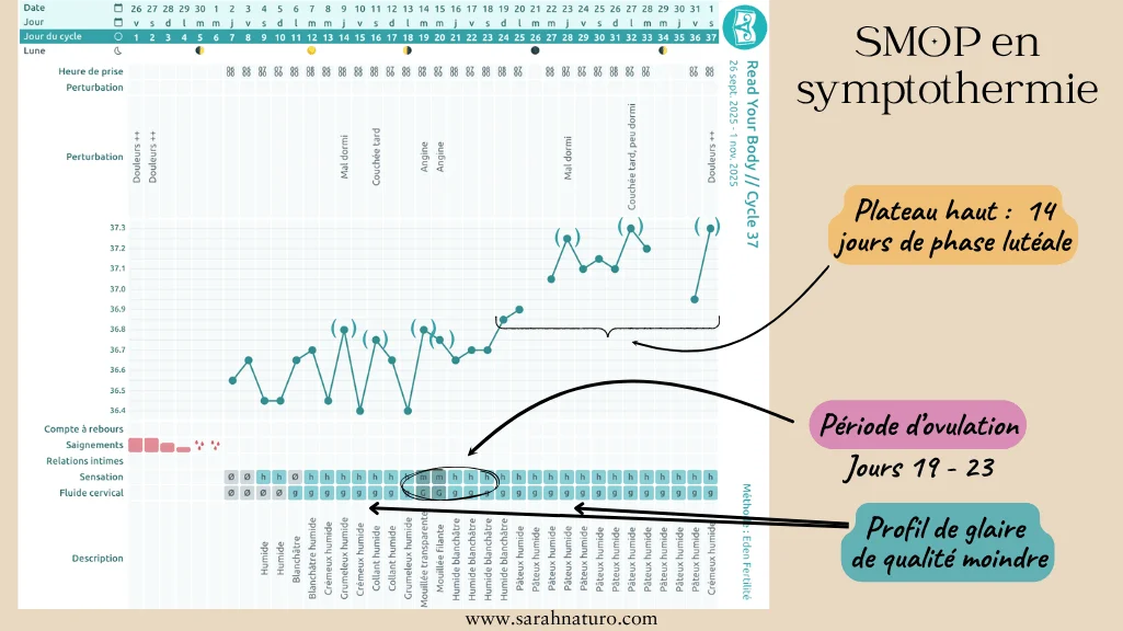 Cyclographe en symptothermie d'une femme avec SOPK montrant une glaire cervicale de faible qualité sur de nombreux jours, une ovulation tardive entre les jours 19 et 23, et un plateau haut de 14 jours