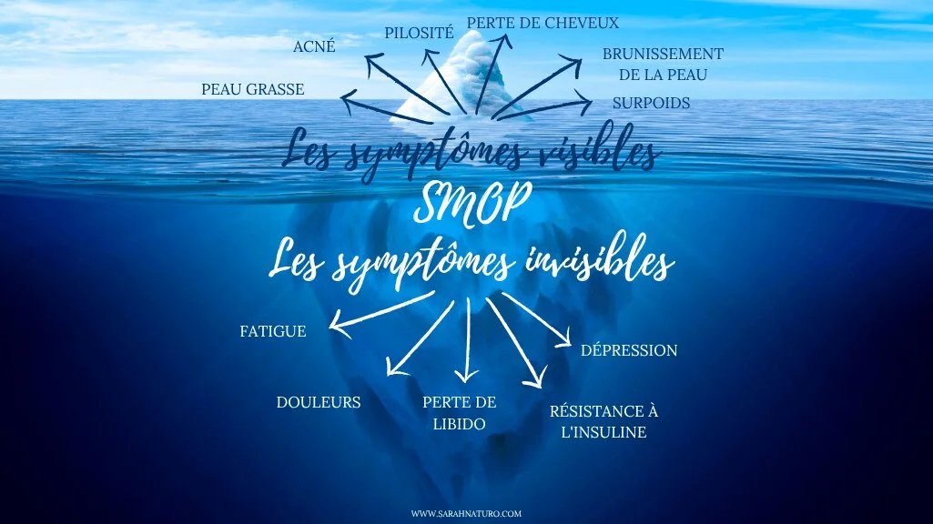 Iceberg illustrant les symptômes visibles du SOPK au-dessus de l'eau (acné, hirsutisme, peau grasse) et les symptômes invisibles en dessous (fatigue chronique, douleurs, dépression)