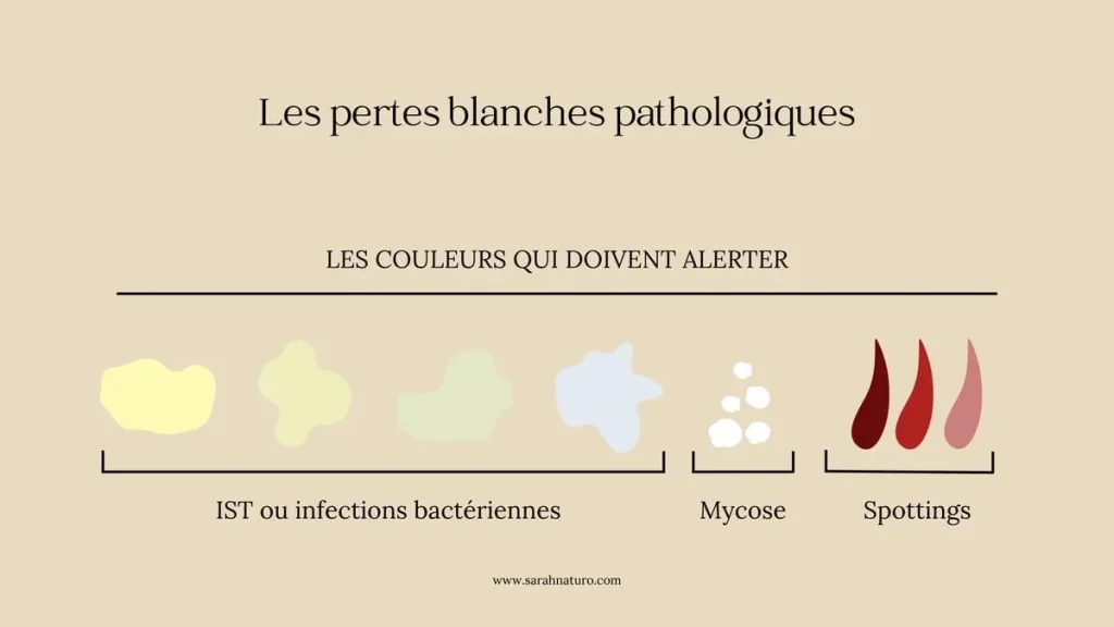 Illustration des pertes blanches anormales : jaunâtres, verdâtres ou grisâtres liées à une IST ou infection bactérienne ; pertes épaisses et grumeleuses typiques de la mycose vaginale ; spottings rosés, bruns ou rouges pouvant indiquer un trouble gynécologique.